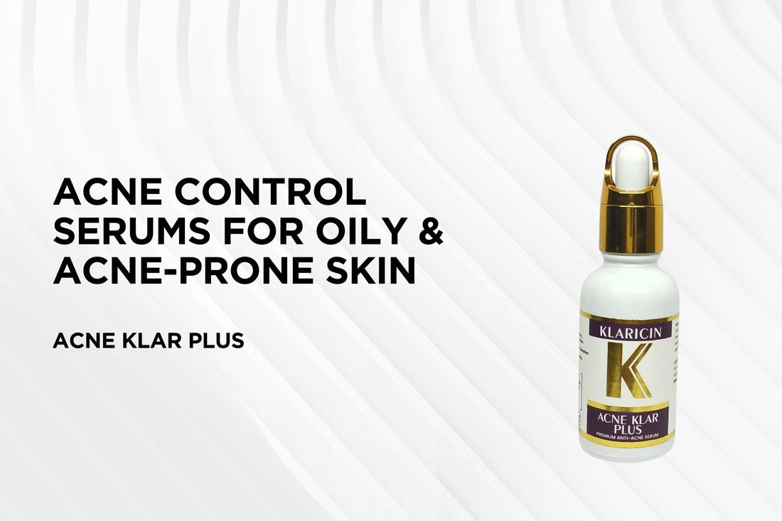 Best Acne Control Serums for Oily & Acne-Prone Skin